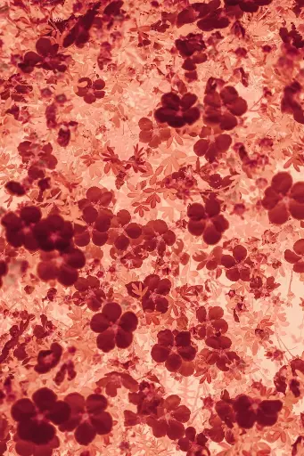 Genomic Approaches to Diagnostic Challenges in Hematological Disorders